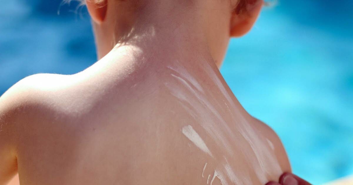 Saúde. “A proteção é o ano todo”: Crianças continuam mal protegidas do sol