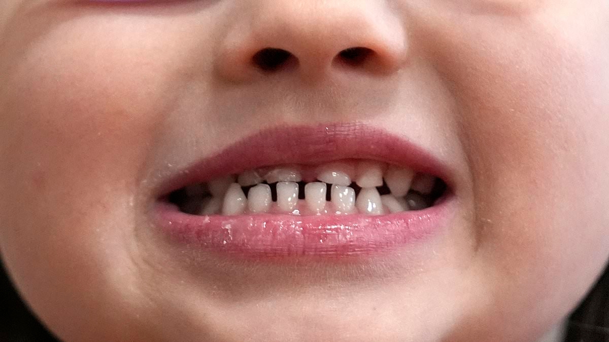 La FDA si muove per vietare integratori popolari per timore che causino DANNI CEREBRALI