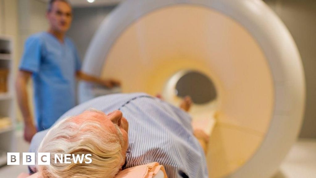 Los hombres reciben tratamientos excesivos para el cáncer de próstata, según una organización benéfica
