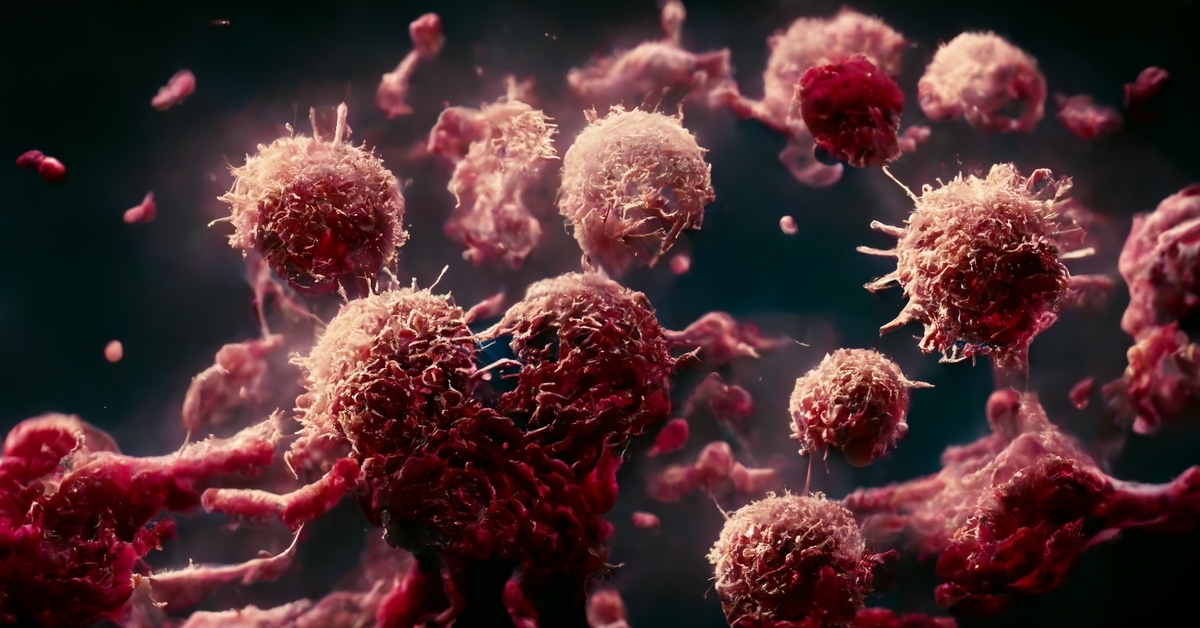 La consommation d'alcool provoque 6 types de cancer différents