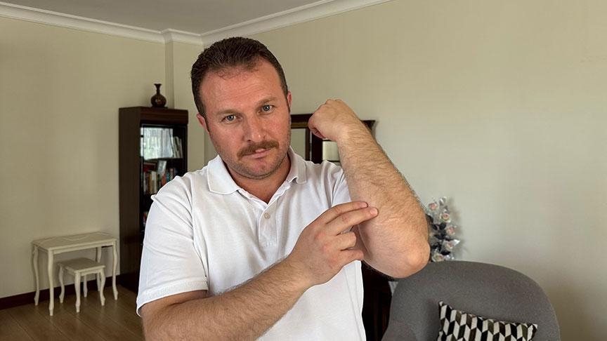 9 yıldır vücudundaki 8 şarapnel parçasıyla yaşıyor