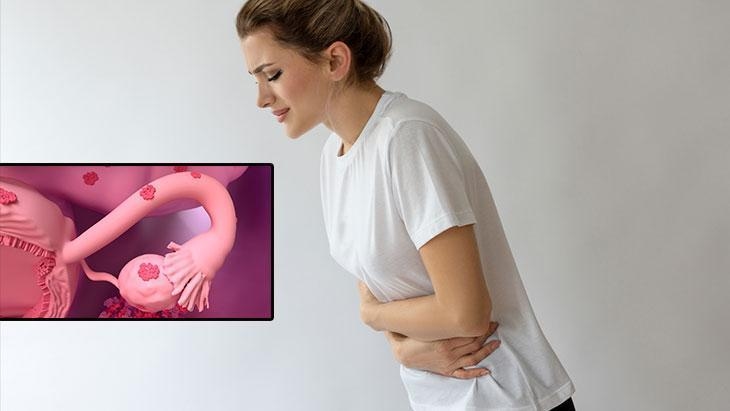 A problem for 1 in 4 women! There are factors that increase and decrease the risk of fibroids.