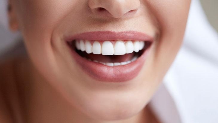 È molto in voga ultimamente! Lo sbiancamento dei denti può essere dannoso?
