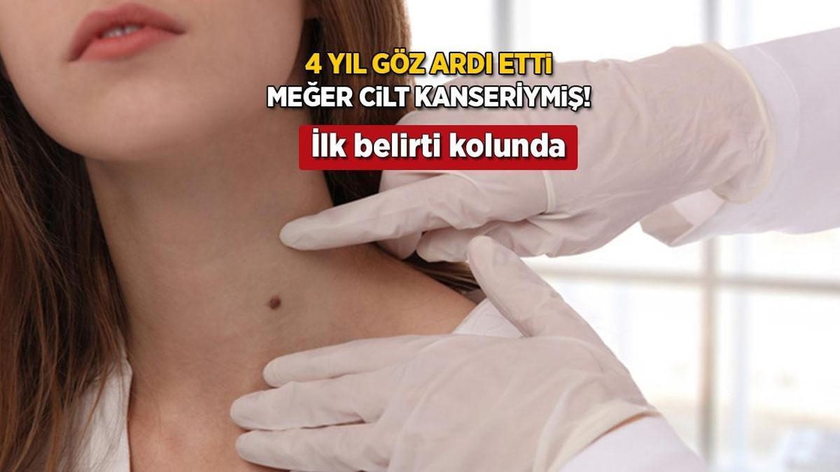 Vier jaar lang maakte het hem niks uit, hij kreeg kanker! Zijn eerste teken is als een stipje: 'Een deel van mijn arm is weggenomen'