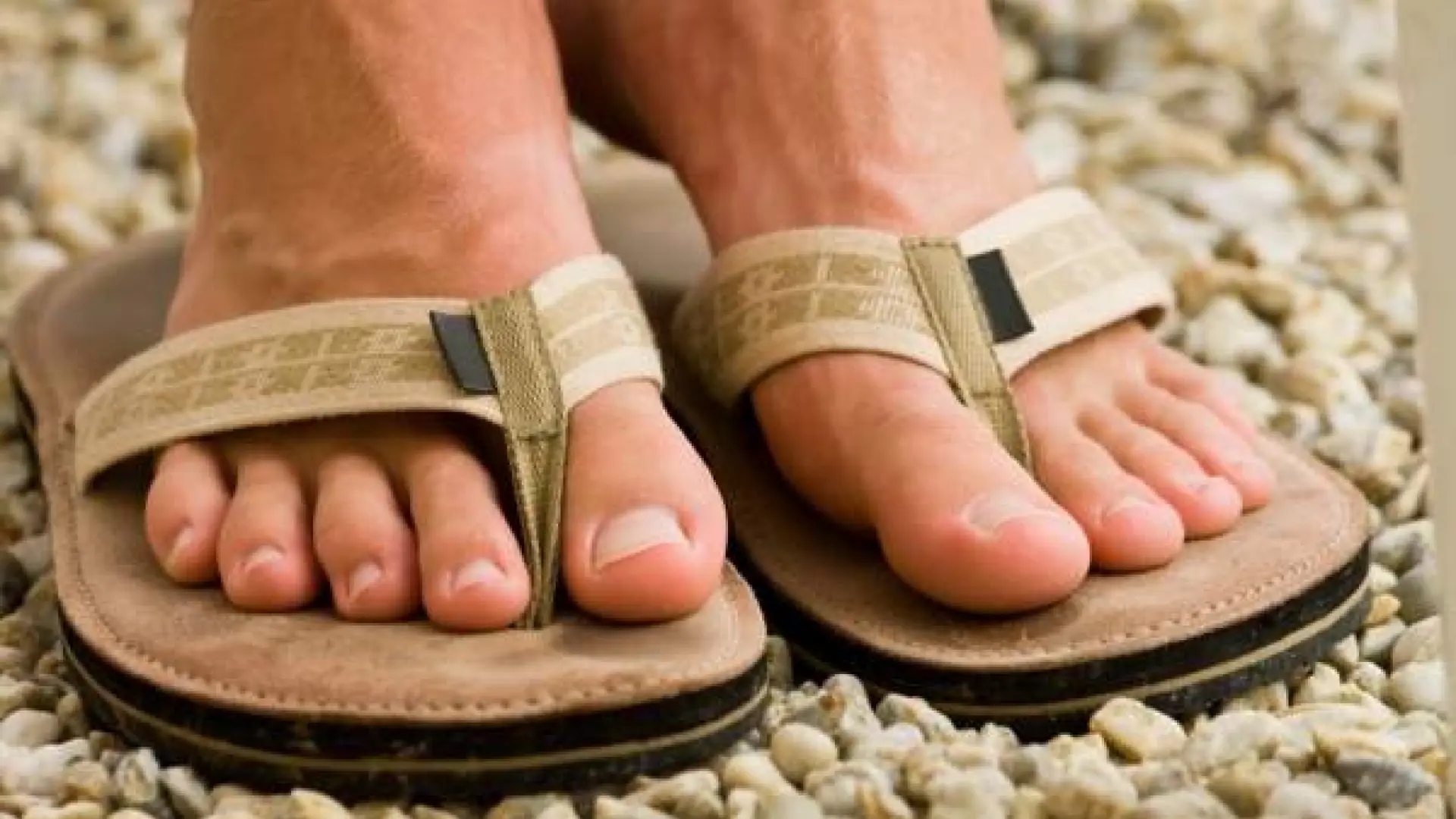 Ein Podologe warnt vor dem Tragen von Flip-Flops, um Verletzungen zu vermeiden: „Ihre Füße werden dafür bezahlen.“
