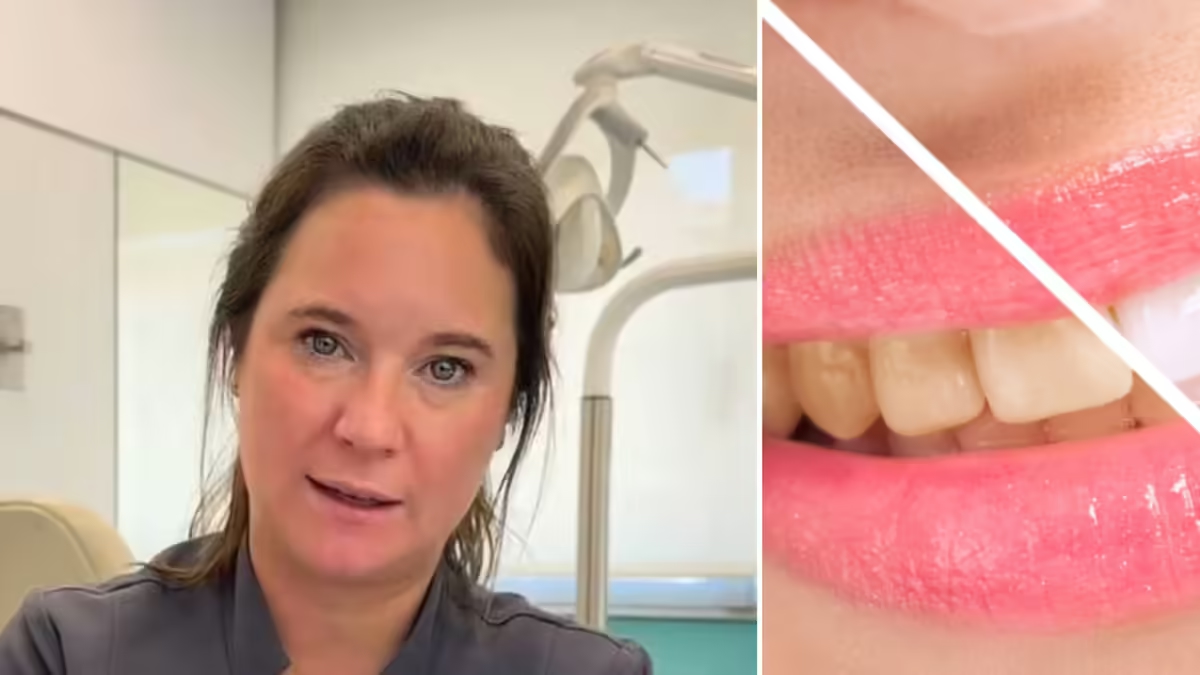 Ein Kieferorthopäde erklärt, warum „gelbe Zähne nicht nur auf mangelnde Hygiene zurückzuführen sind“ und was man tun kann, um ihre Farbe zu verbessern.