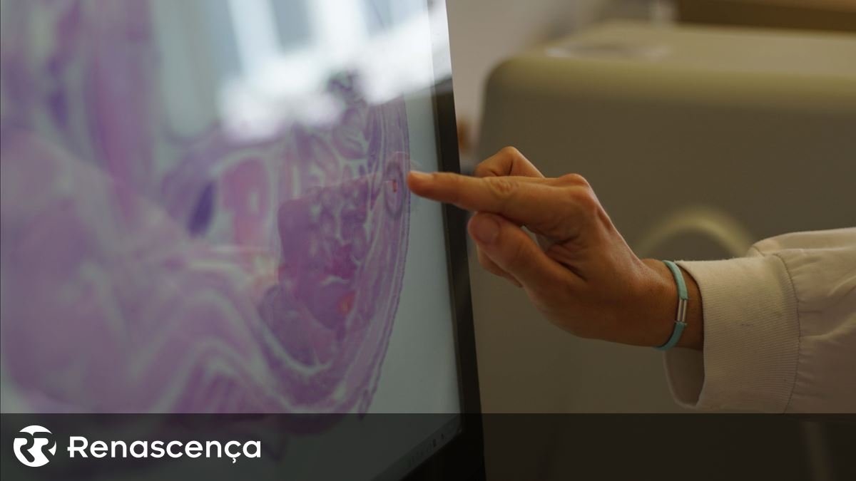 Brains aged faster during the pandemic, study says