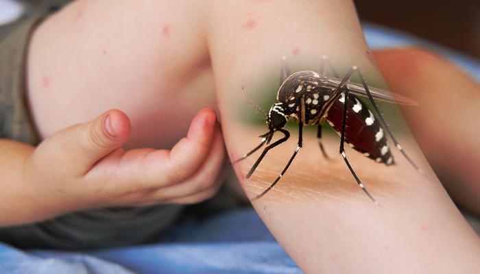Alerte à la pandémie mondiale ! L’OMS met en garde tous les pays : le virus « Chikungunya » transmis par les moustiques représente une menace ! Le virus « Chikungunya » est-il présent en Turquie ?
