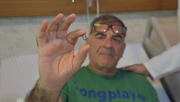 Fue al hospital quejándose de tos y se llevó el susto de su vida: ¡le salió un implante dental del pulmón!