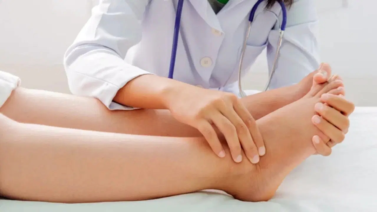 Effective ways to deal with edema