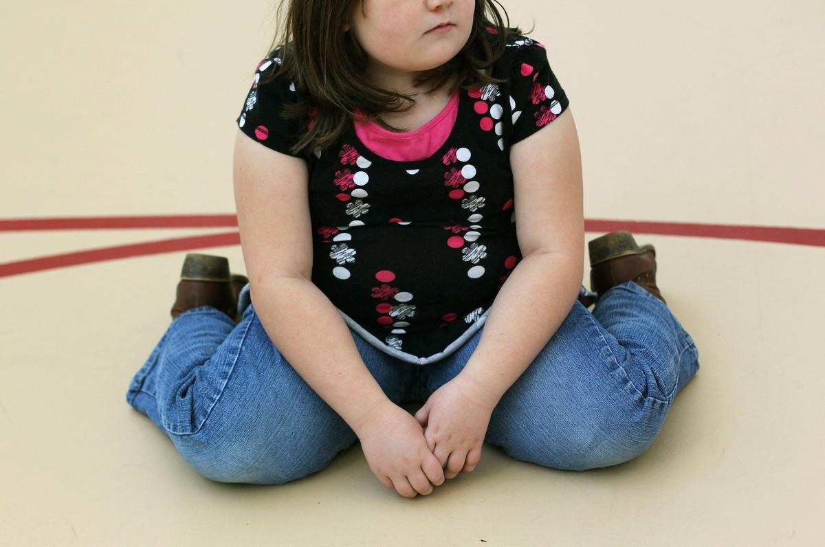 La obesidad infantil ya supera a la desnutrición en niños y adolescentes, advierte UNICEF