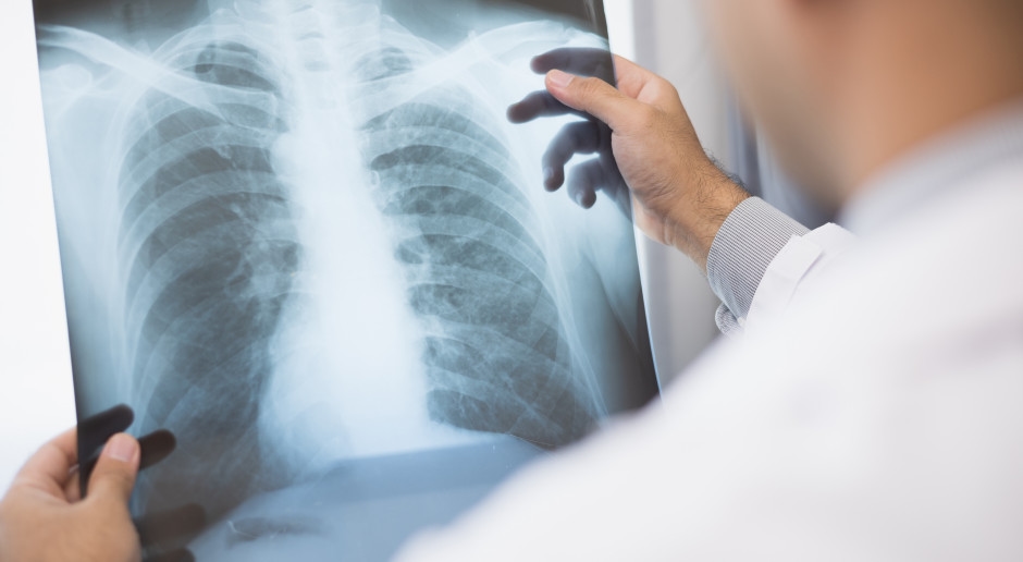 50% of lung cancer patients are over 70 years old
