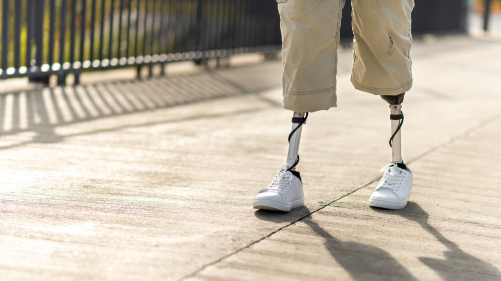 Het ministerie van Arbeid heeft een norm goedgekeurd voor prothesen voor gehandicapten die gewond zijn geraakt tijdens militaire operaties