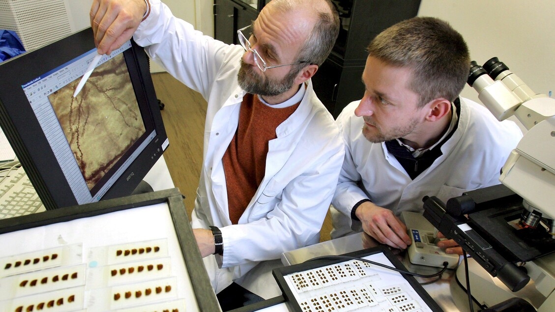 Alzheimer, test su una tecnica automatica per la diagnosi precoce