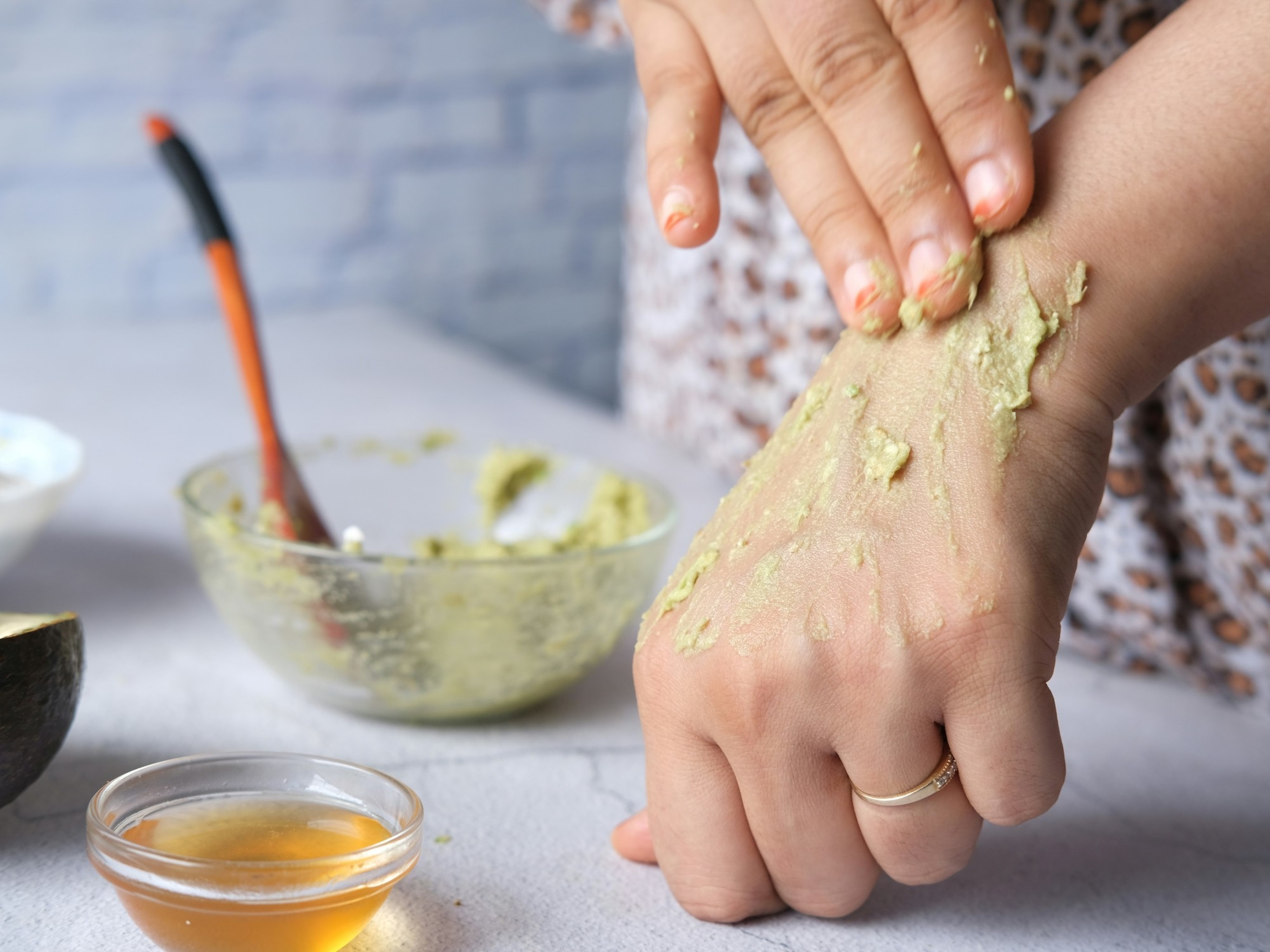 Chau a las cremas: el truco de cocina para aliviar las quemaduras del sol