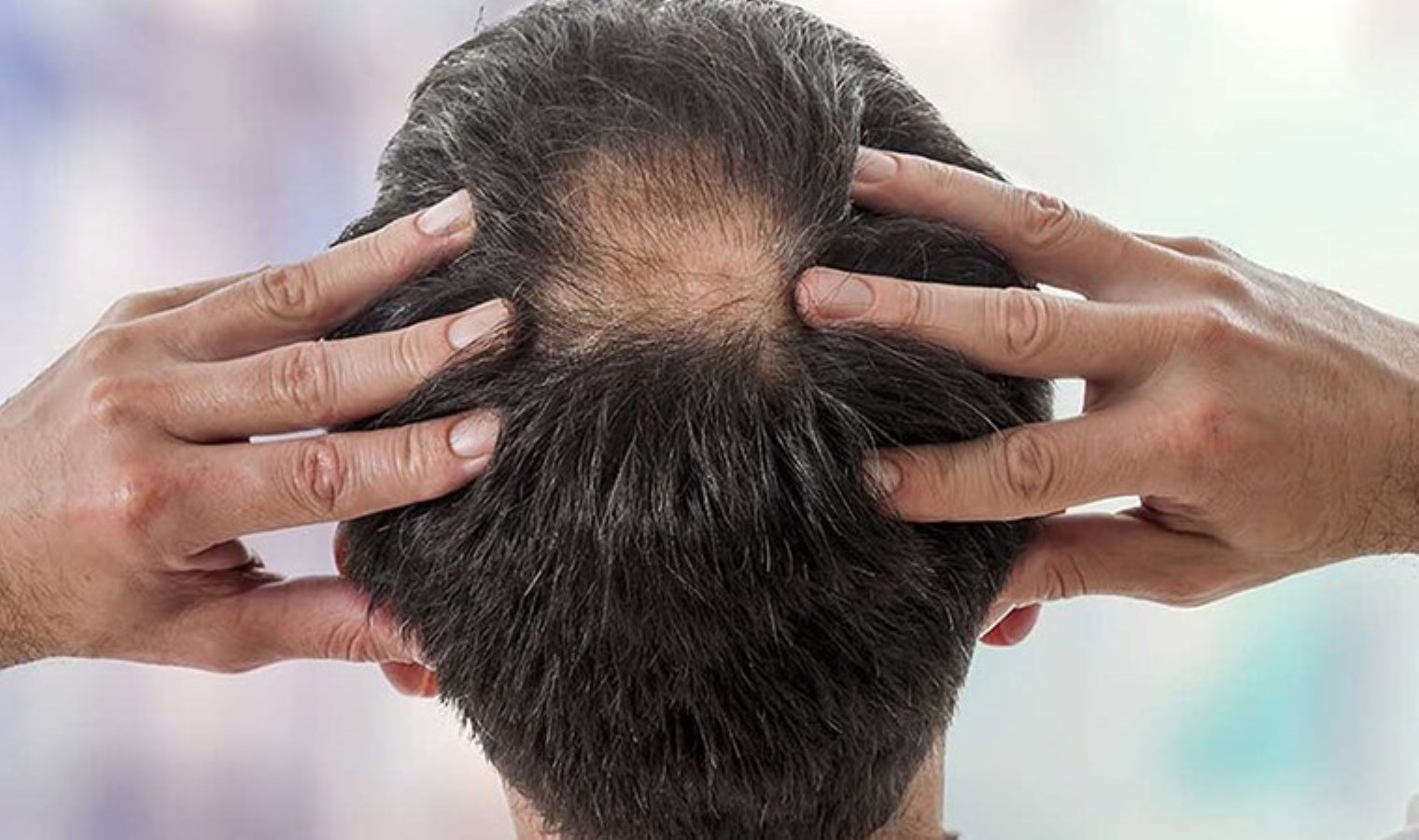 Avertissement critique d'un expert : « Si la perte de cheveux a progressé, les médicaments ne seront pas efficaces »
