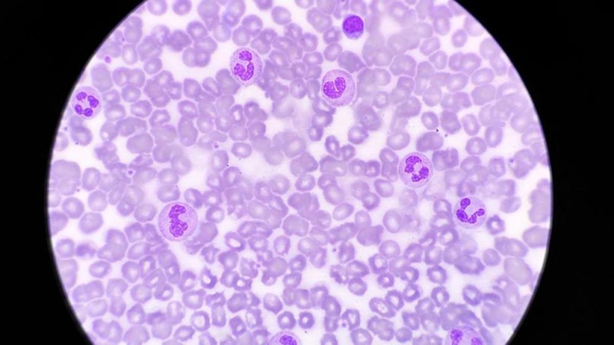 La luce del giorno può aumentare la capacità del sistema immunitario di combattere le infezioni