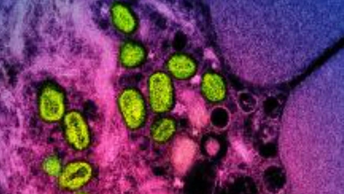 Spain reports first death from MPOX, or monkeypox, since 2022.