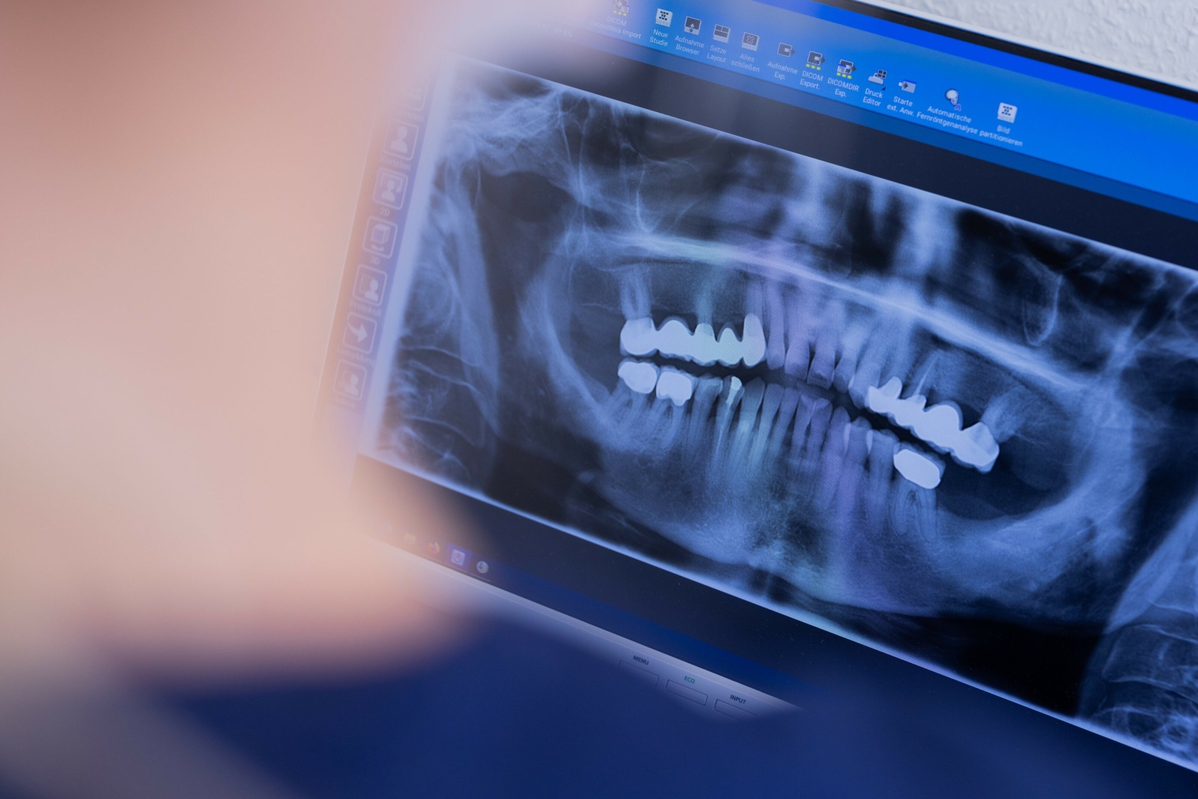 Health | Economic Medicine: Wait and see or bill?