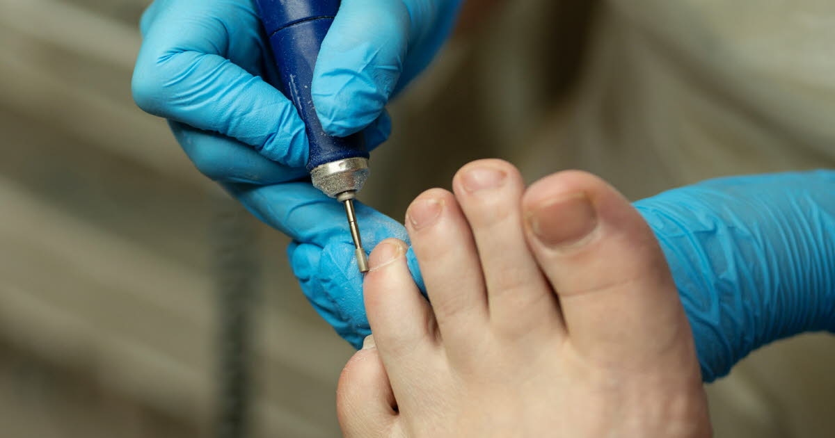 Health. Ingrown toenails, circulatory problems... When should you consult a podiatrist?