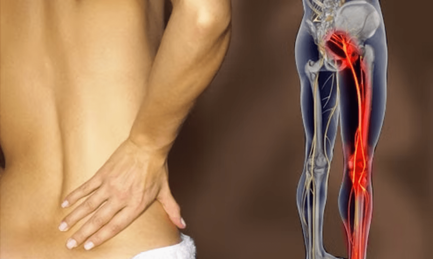 Siyatik ağrısı: Nasıl teşhis edilir, nedenleri nelerdir ve nasıl hafifletilir?