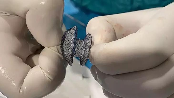 Dziura w sercu nie jest już straszna: Leczenie w 15 minut nowoczesną metodą zamkniętą