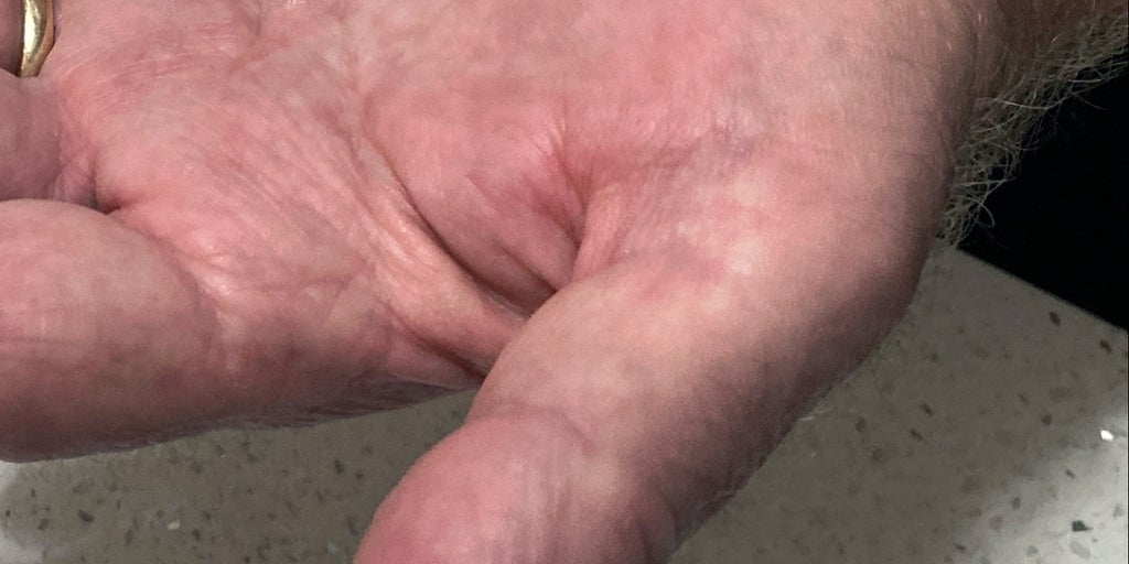 Melatonin takviyeleri göründüğü kadar zararsız değildir.