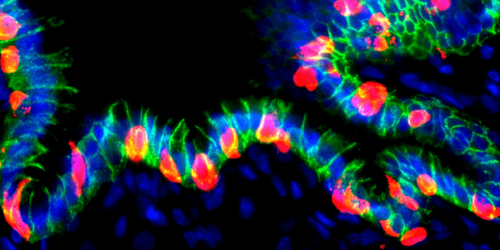 Células estomacais reprogramadas produzem insulina para tratar diabetes.