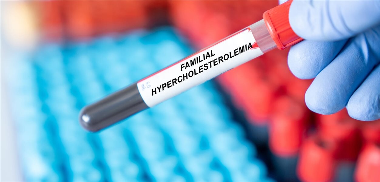 Ailevi hiperkolesterolemi: Erken tanı ve yoğun tedavi