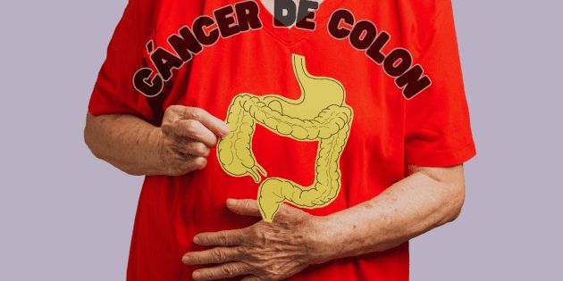 La pericolosa avanzata del cancro al colon in Messico